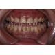 Customization Porcelain Teeth Veneers With Smooth Surface Texture