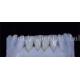 Thin Synthetic Laminate Veneer Teeth 0.3-0.5mm Thick Beautiful  Looking