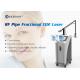 metal tube Fractional CO2 Laser Machine for scar removal