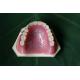 ISO13485 Conventional Denture Upper Acrylic Partial