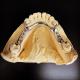 Fast and Cast Framework Co-Cr Metal Partial Denture Framework for Dental Professionals
