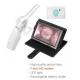 Vaginal Camera for Women Care Digital Mini Colposcope 1.5 Times Magnification 10cm Observation Distance