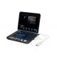 128 Images Permanent Storage Portable Digital Ultrasound Scanner with 12 Inch LED Screen