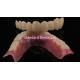 Highly Durable And Natural-Looking Layered Porcelain For Layered Dental Zirconia Crown China Dental Lab