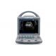 Portable Echocardiography Machine Portable Ultrasound Scanner With 10.4 Inch Adjustable Monitor