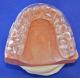 Semi Hard Soft Occlusal Mouth Guard Dental Comfortable FDA Certified