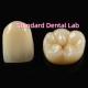Biocompatible Material Aesthetic Zirconia Crown Zirconia Bridge Teeth