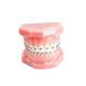 Smooth Surface Orthodontic Metal Bracket Durable Fixed Appliance