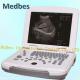 15 Inch High Definition LED Screen Handheld Ultrasound Scanner Machine with Built-in Battery
