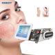 Medical Clinic 1470nm Invasive Laser Therapy Instrument Hemorrhoids Removal