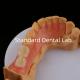 3D Print Model High Esthetics Dental TCS Valplast Flexible Partial Dentures Dental Lab