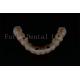 Replacement All On 4 All On 6 Advanced Dental Implants For Optimal Functionality