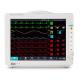 12.1 Color Touch Screen Patient Monitor