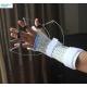 Thermoplastic Dynamic Finger Extension Splint Occupational Therapy