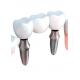 Realistic Appearance Bridges And Dental Crowns Strong Stability Natural Color