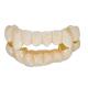 Healthy  Dental Crown Bridge High Strength And Make The Smile More Beautiful
