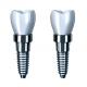Consistency In Every Crown Our Dental Implant Crown Manufacturing Process