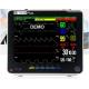 Multi-parameter patient monitor ,ETCO2 available ,12 inch portable patient monitor/ ICU, CCU, operating theaters,etc.