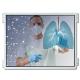 10.4 inch INNOLUX G104X1-L03 IPS LCD Display for Smart Medical Application Resolution 1024*768