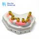 Metal Multi Unit Abutment Scanbody Implant Multi Unit Scan Body For Implant