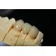 Customized Zirconia Denture Dental lab - Fast Delivery and Repair