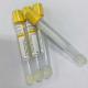 5ml SST Gel Clot Activator Blood Collection Tube Yellow Cap