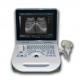 TGC Control Notebook Scanner Laptop Ultrasound Machine For Pregnancy Home