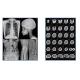 8x10 10x12 10x14 11x14 14x17 Medical X Ray Film With High Contrast Max Density 3.0D