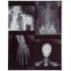 Blue Color 10X12 Inch Inkjet Pet Medical X-ray Film/Image
