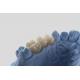 Full Contour Dental Lab Crowns High Translucency Solid Zirconia Crown