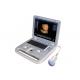 4D B W Color Doppler Portable Ultrasound Device , Laptop Ultrasound Machine With 15 Inch LED