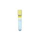 Hospital Plastic Glass SST Tube Medical Serum Separating Gel Clot Blood Collection