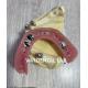 Ni Be Free Dental Lab Crowns Telescopic Secondary Primary Teeth Crowns