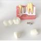 Patient Education Models Dental Teeth Demonstration