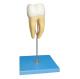 16 Times Life Size Of Molar Model For Hosiptals And Medical Schools Training