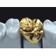 High Nobel Yellow Gold Crown Professional Ni Be Free ISO Approved