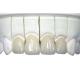 3D Printed Zirconia Dental Crown Wear Resistant Highly Biocompatible