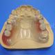 Easy To Clean And Adjust Partial Dental Prosthesis Durable Comfortable