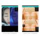 10.6kg Gw Face Skin Analysis System 20mega Pixels Fda Fc Certificate