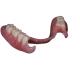Glossy Bonded Titanium Composite Dentures For Denture Dental Lab