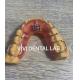 Fixed Dental Teeth Palate Expander Professional For Maxillary Mandibular