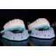 Stain Resistant Dental Teeth Veneers Dental Clinic Veneers 0.3mm-0.5mm Thickness