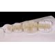 Translucency Zirconia Dental Inlay Onlay Crown For Restore Natural Cavity Shape