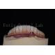 Natural looking Titanium or Zirconia Dental Implants Minimally Invasive
