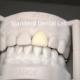 Digital CAD CAM Dental Lab Crowns Translucent Layered Zirconia Crown