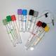 Screw Closure Blood Sample Collection Tubes Vacuum / Non Vacuum Type For Lab Research