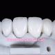 Natural Looking Restorations Aidite Dental Zirconia Tooth Crown