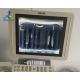  HD11 Image Blurred Image Anomaly Ultrasound Machine Repair Monitor