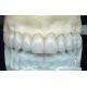 Dental Lab Zirconia Crowns And Bridge Works Professional Stable