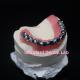 Full Arch Malo Bridge Dental Restoration Zirconia Crowns With Gum Poecelian China Dental Lab